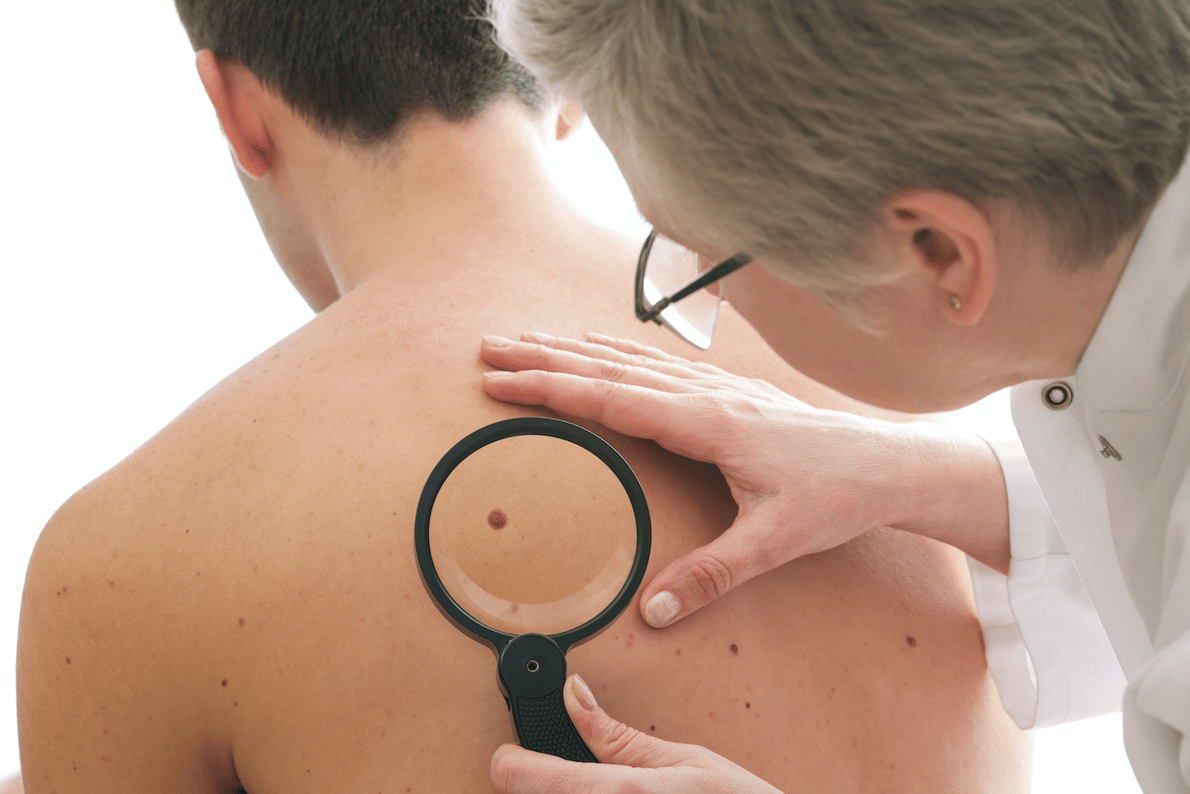 Does Medicare Cover Skin Cancer