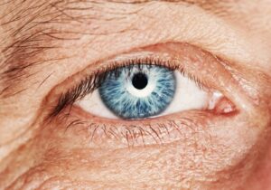 does Medicare cover eyelid surgery
