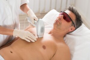 does Medicare cover laser hair removal