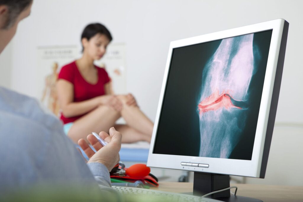 Does Medicare Cover Coolief Knee Treatment