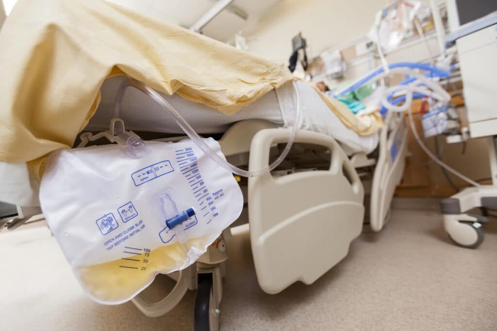 urinary catheter hooked up to patient in hospital bed in article about does Medicare cover purewick 